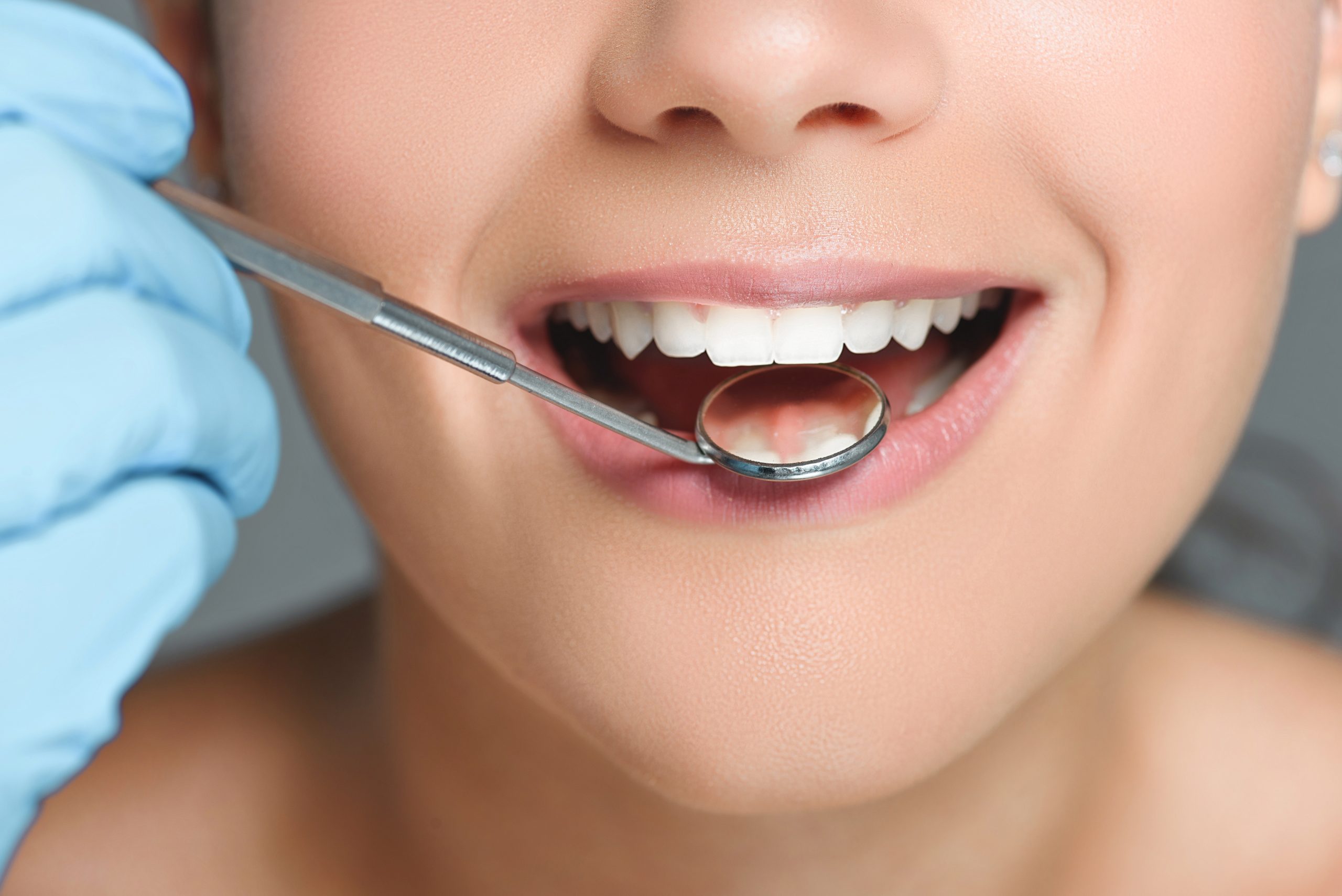 Silver Vs  Tooth Colored Fillings: Making An Informed Choice For Your Dental Health